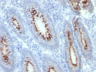 CD66 / CEA Monoclonal Mouse Antibody (C66/261)