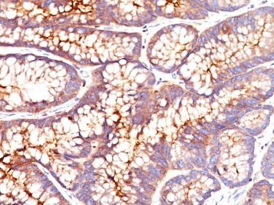 CD66 / CEA Monoclonal Mouse Antibody (CEA31)