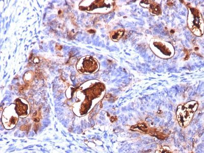 CD66 / CEA Monoclonal Mouse Antibody (COL-1 + CEA31 + C66/261)