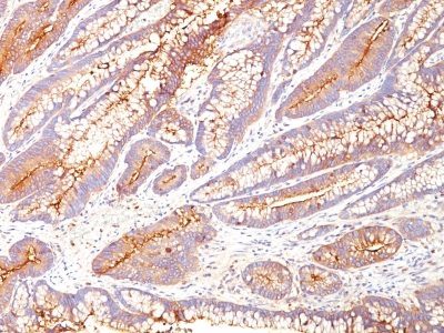 CD66 / CEA Monoclonal Mouse Antibody (COL-1)
