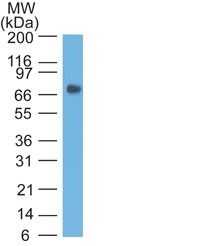 CD66 / CEA Monoclonal Mouse Antibody (COL-1)
