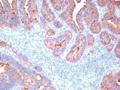 CD66 / CEA Pan Monoclonal Mouse Antibody (C66/195 + C66/261 + C66/1009 + C66/1030)