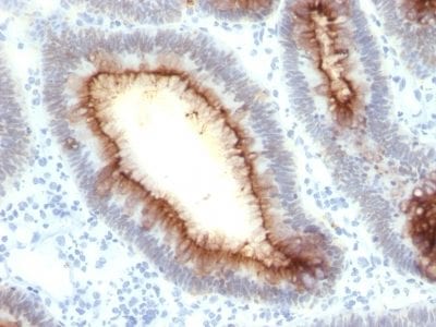 CD66 / CEA Recombinant Monoclonal Mouse Antibody (rC66/1009)