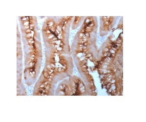 CD66 / CEA Recombinant Monoclonal Rabbit Antibody (C66/1983R)