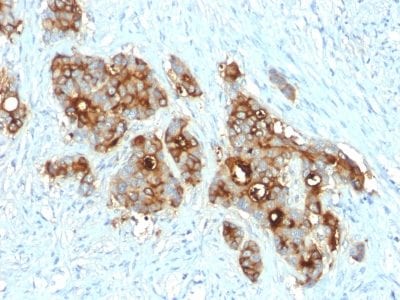 CD66 / CEA Recombinant Monoclonal Rabbit Antibody (C66/2055R)