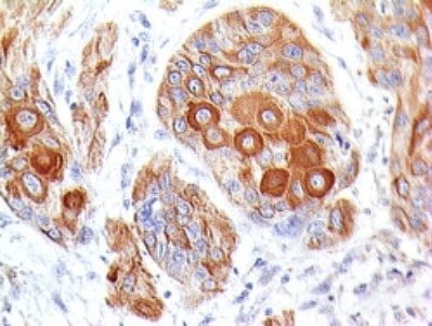 CD86 Monoclonal Mouse Antibody (BU63)