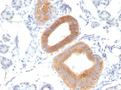 CD86 Monoclonal Mouse Antibody (C86/1146)