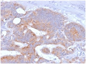 CD86 Recombinant Monoclonal Mouse Antibody (rC86/1146)