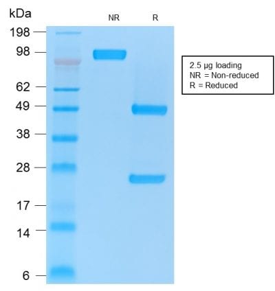CD86 Recombinant Monoclonal Mouse Antibody (rC86/1146)