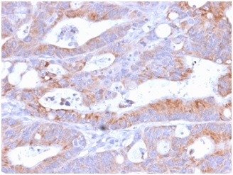 CD86 Recombinant Monoclonal Rabbit Antibody (C86/2160R)