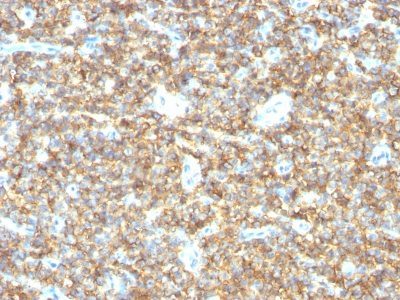 CD99 Monoclonal Mouse Antibody (HO36-1.1)
