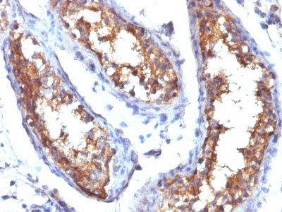CD99 Monoclonal Mouse Antibody (HO36-1.1)