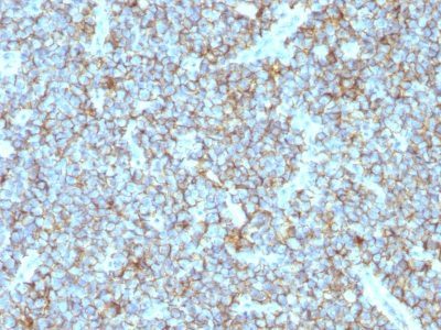 CD99 Monoclonal Mouse Antibody (MIC2/877)