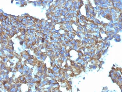CD99 Monoclonal Mouse Antibody (MIC2/877)