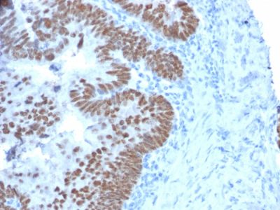 CDX2 / Caudal Type Homeobox 2 Monoclonal Mouse Antibody (CDX2/2214)
