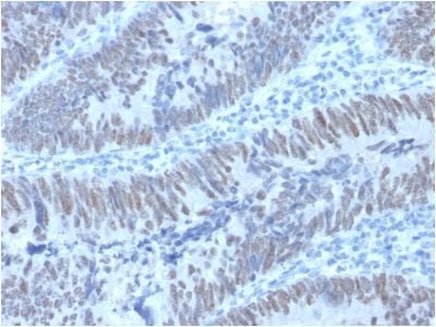 CDX2 / Caudal Type Homeobox 2 Monoclonal Mouse Antibody (PCRP-CDX2-1A3)