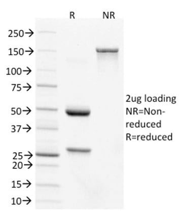 CDX2 / Caudal Type Homeobox 2 Monoclonal Mouse Antibody (PCRP-CDX2-1A3)