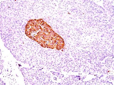 Chromogranin A Monoclonal Mouse Antibody (CGA/414)
