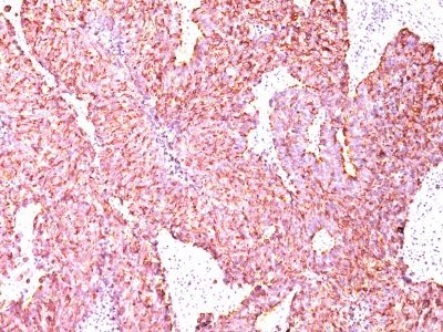 Chromogranin A Monoclonal Mouse Antibody (CGA/414)