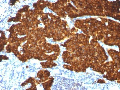 Chromogranin A Monoclonal Mouse Antibody (CGA414 + CGA/777 + CGA/798)
