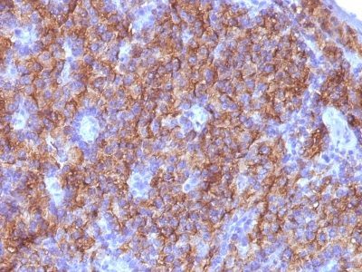 Chromogranin A Monoclonal Mouse Antibody (CGA414 + CGA/777 + CGA/798)