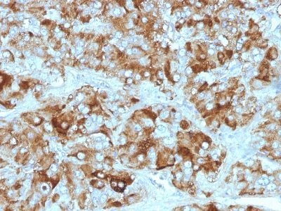Chromogranin A Monoclonal Mouse Antibody (CGA414 + CGA/777 + CGA/798)