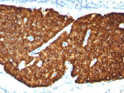 Chromogranin A Monoclonal Mouse Antibody (CHGA/413)