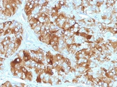 Chromogranin A Monoclonal Mouse Antibody (CHGA/413)