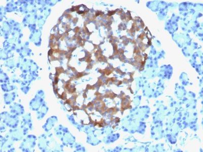 Chromogranin A Monoclonal Mouse Antibody (CHGA/765)