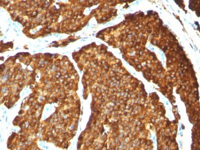 Chromogranin A Monoclonal Mouse Antibody (CHGA/777)