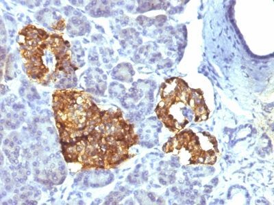 Chromogranin A Monoclonal Mouse Antibody (CHGA/777)