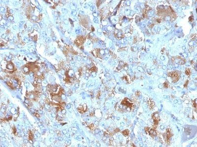 Chromogranin A Monoclonal Mouse Antibody (CHGA/777)