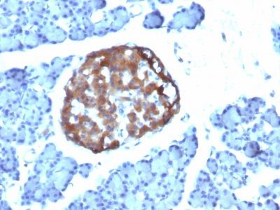 Chromogranin A Monoclonal Mouse Antibody (CHGA/798)