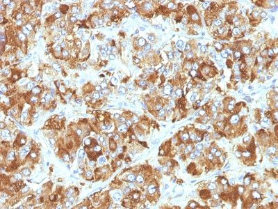 Chromogranin A Monoclonal Mouse Antibody (CHGA/798)