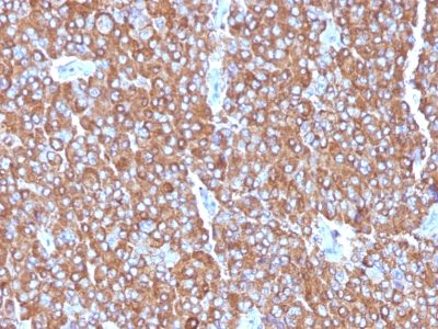 Chromogranin A Monoclonal Mouse Antibody (LK2H10 + PHE5 + CGA414)