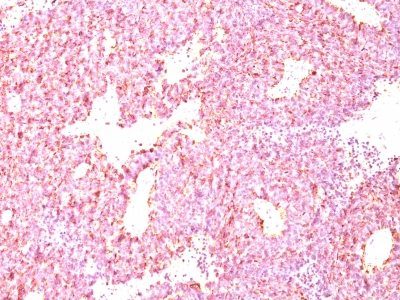 Chromogranin A Monoclonal Mouse Antibody (LK2H10 + PHE5)