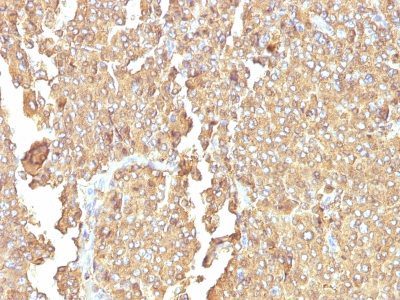Chromogranin A Monoclonal Mouse Antibody (LK2H10 + PHE5)