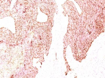 Chromogranin A Monoclonal Mouse Antibody (LK2H10)