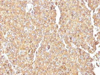 Chromogranin A Monoclonal Mouse Antibody (LK2H10)