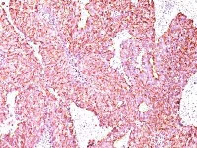 Chromogranin A Monoclonal Mouse Antibody (PHE5)