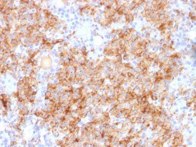 Chromogranin A Polyclonal Rabbit Antibody