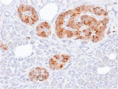 Chromogranin A Recombinant Monoclonal Mouse Antibody (rCHGA/413)