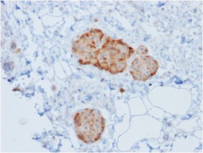 Chromogranin A Recombinant Monoclonal Mouse Antibody (rCHGA/777)