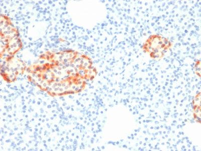 Chromogranin A Recombinant Monoclonal Mouse Antibody (rCHGA/798)
