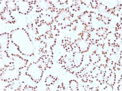 Cyclin D1 Monoclonal Mouse Antibody (CCND1/2593)