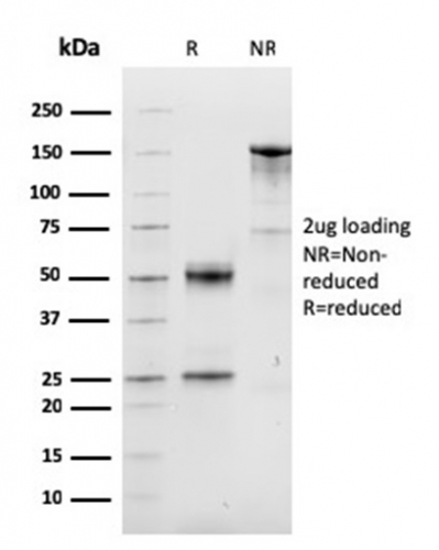 Cyclin D1 Monoclonal Mouse Antibody (CCND1/3548)