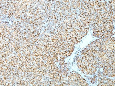 Cyclin D1 Monoclonal Mouse Antibody (CCND1/809)