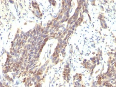 Cyclin D1 Monoclonal Mouse Antibody (CCND1/809)