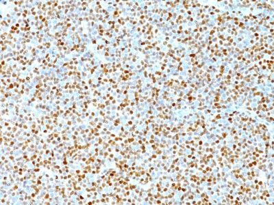 Cyclin D1 Monoclonal Mouse Antibody (DCS-6)