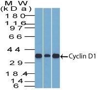 Cyclin D1 Monoclonal Mouse Antibody (DCS-6)